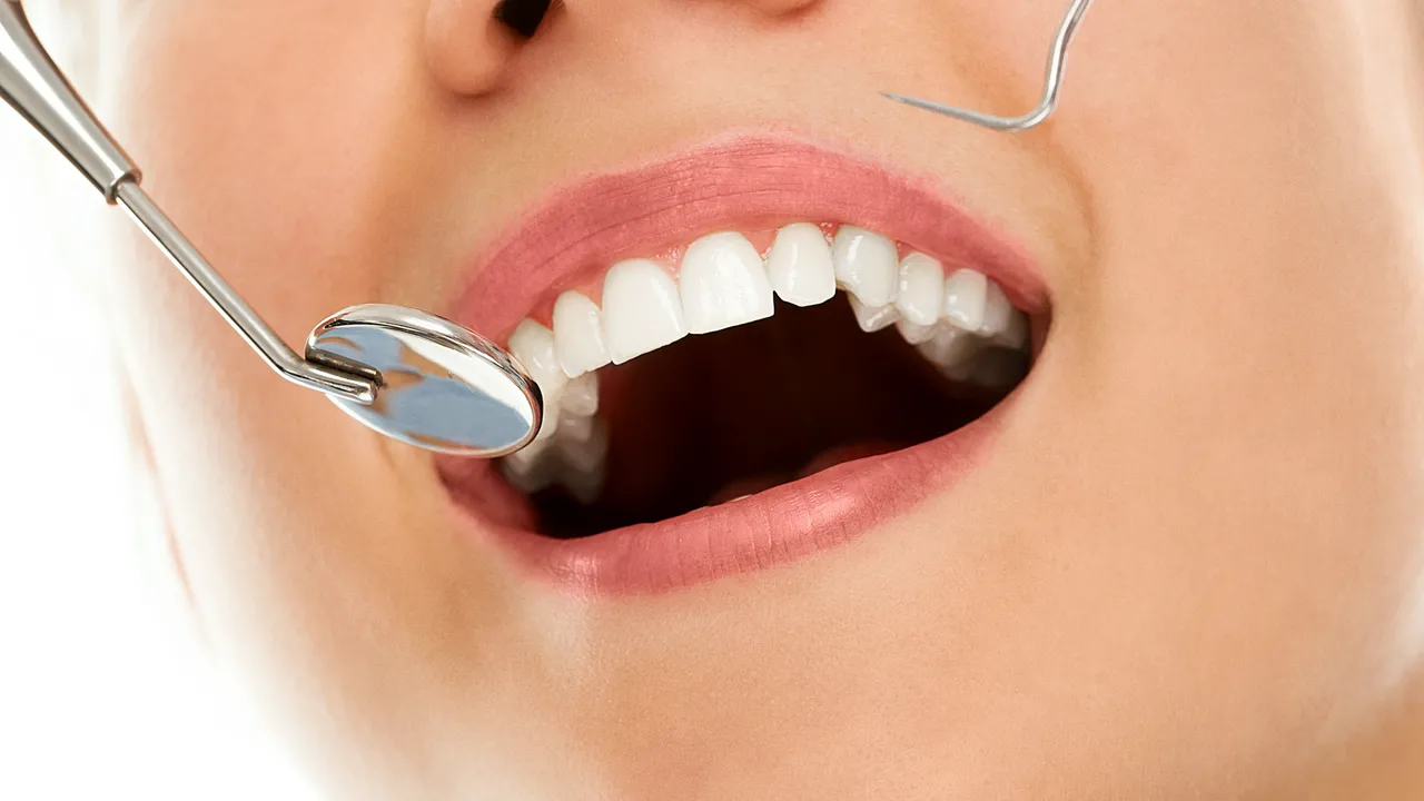 Mengapa Memilih Klinik Gigi Axel Dental Indonesia